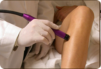 Laser Hair Removal - Sessions