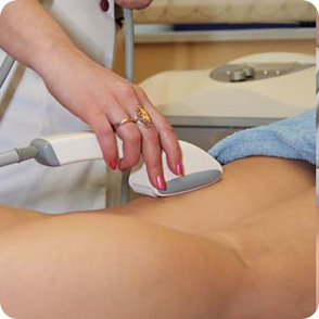 Laser Hair Removal - Temporary Side Effects